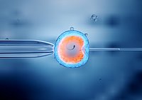 in vitro Befruchtung der Eizelle