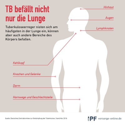 TB und andere Organe